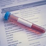 cholesterol a długowieczność: probówka z krwią na wydruku lipidogramu